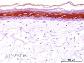 Marquage de la cytokeratine 10 dans une peau reconstruite Marquage de la cytokeratine 10 dans une peau reconstruite