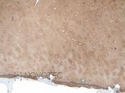 Purified freeze-dried antibody to human type II collagen