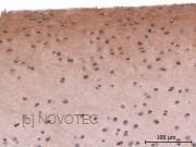 Purified freeze-dried antibody to bovine type II collagen