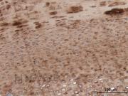 Purified freeze-dried antibody to chicken type II collagen