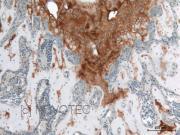 Purified freeze-dried antibody to mouse type II collagen