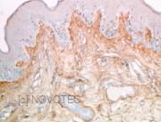 Purified freeze-dried antibody to human type VI collagen