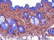 Purified freeze-dried antibody to mouse type I procollagen