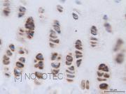 Purified freeze-dried antibody to bovine type XI collagen