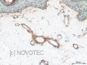 Purified freeze-dried antibody to endostatin